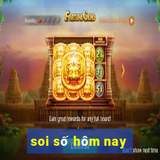 soi số hôm nay