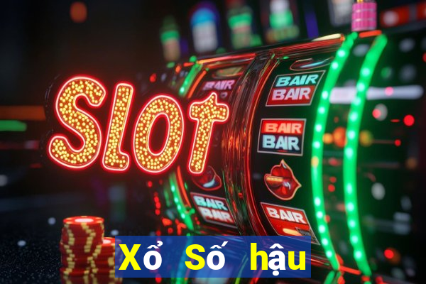 Xổ Số hậu giang Dự Đoán Xổ Số Chủ Nhật