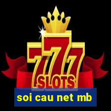 soi cau net mb