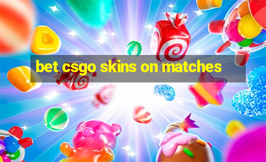 bet csgo skins on matches