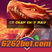 đứt chân chảy máu