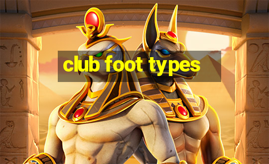 club foot types