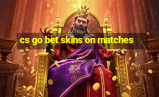 cs go bet skins on matches