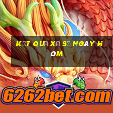 kết quả xổ số ngày hôm